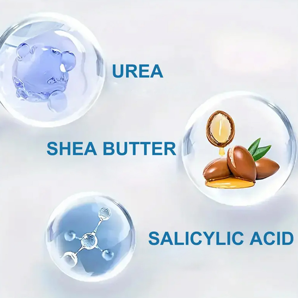 YOUNGCOME 250G Urea Cream with - مراجعة Urea Foot Cream وسعره