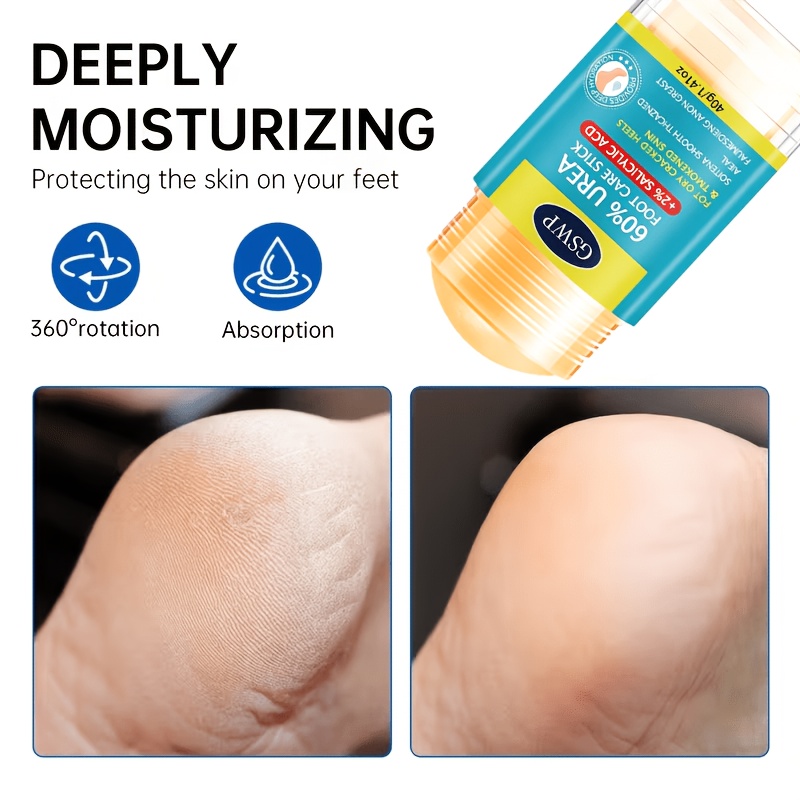 GSWP 60% Urea Foot Care Stick, - مراجعة Urea Foot Cream وسعره