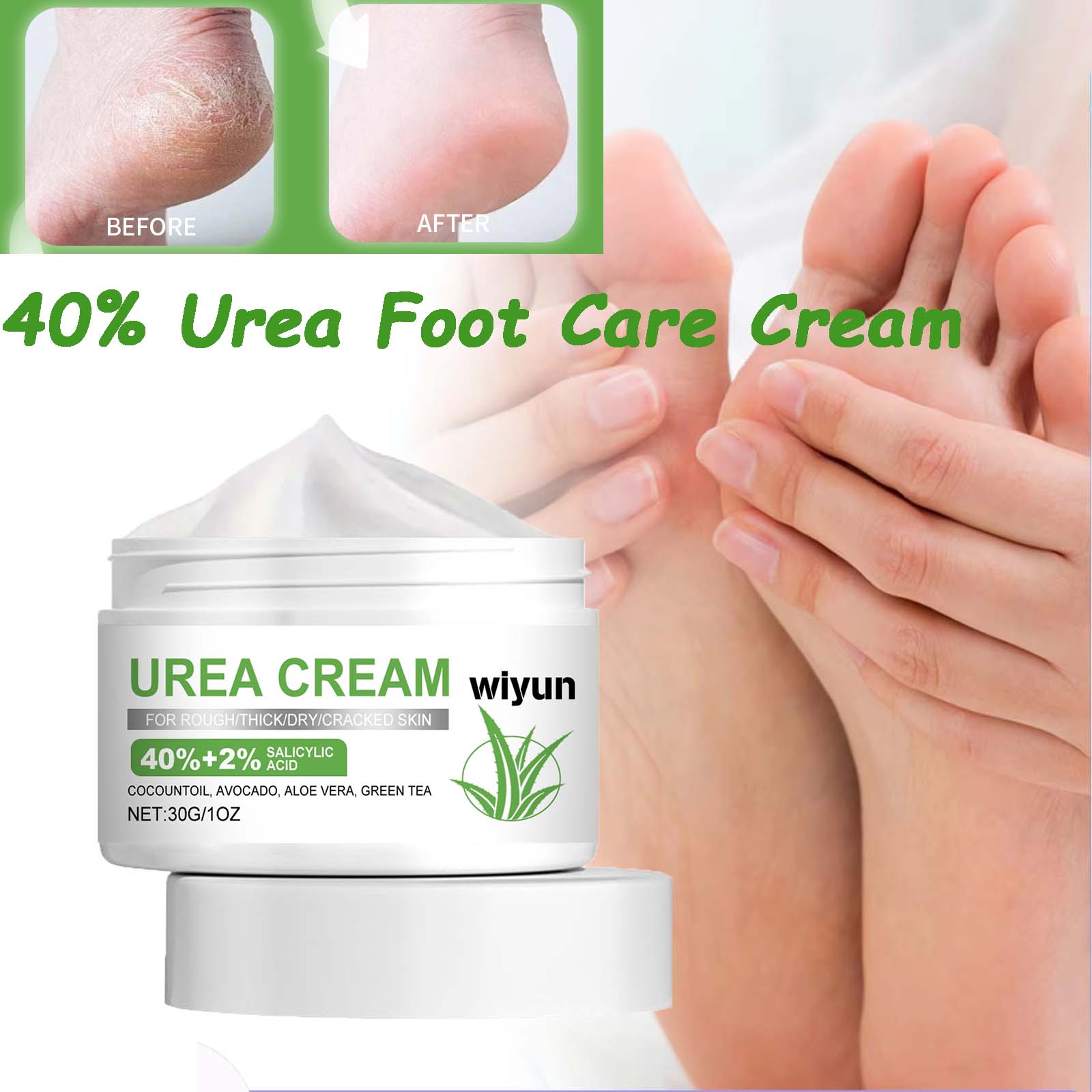 40% Urea Foot Care Cream Overn - مراجعة Urea Foot Cream وسعره