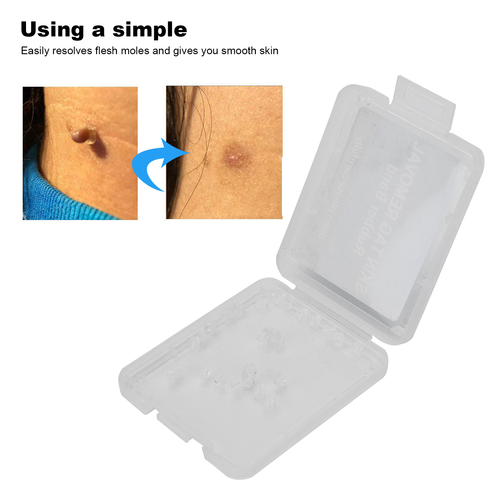 30Pcs Painless Skin Tag Remova - مراجعة Skincare Ingredients Checker وسعره