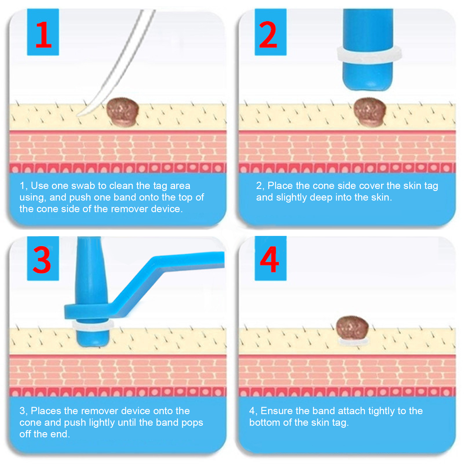30Pcs Painless Skin Tag Remova - مراجعة Skincare Ingredients Checker وسعره