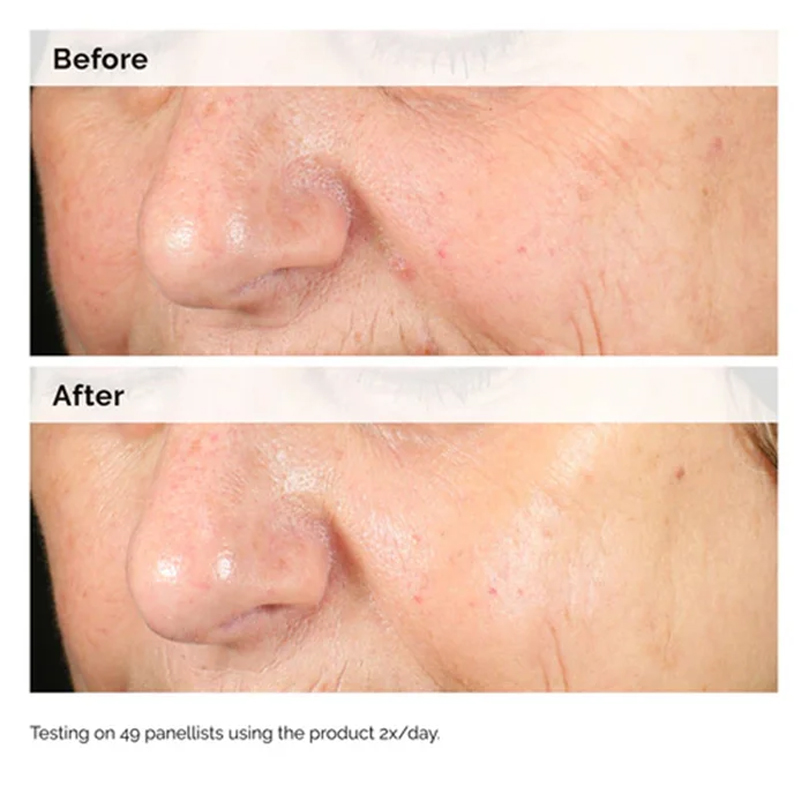 Alpha Arbutin 2% + HA 30ml Ser - مراجعة Alpha Arbutin Serum وسعره