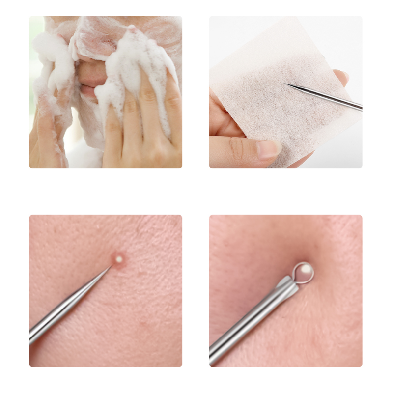4pcs/set Acne Removal Needles  - مراجعة Skincare Ingredients Checker وسعره