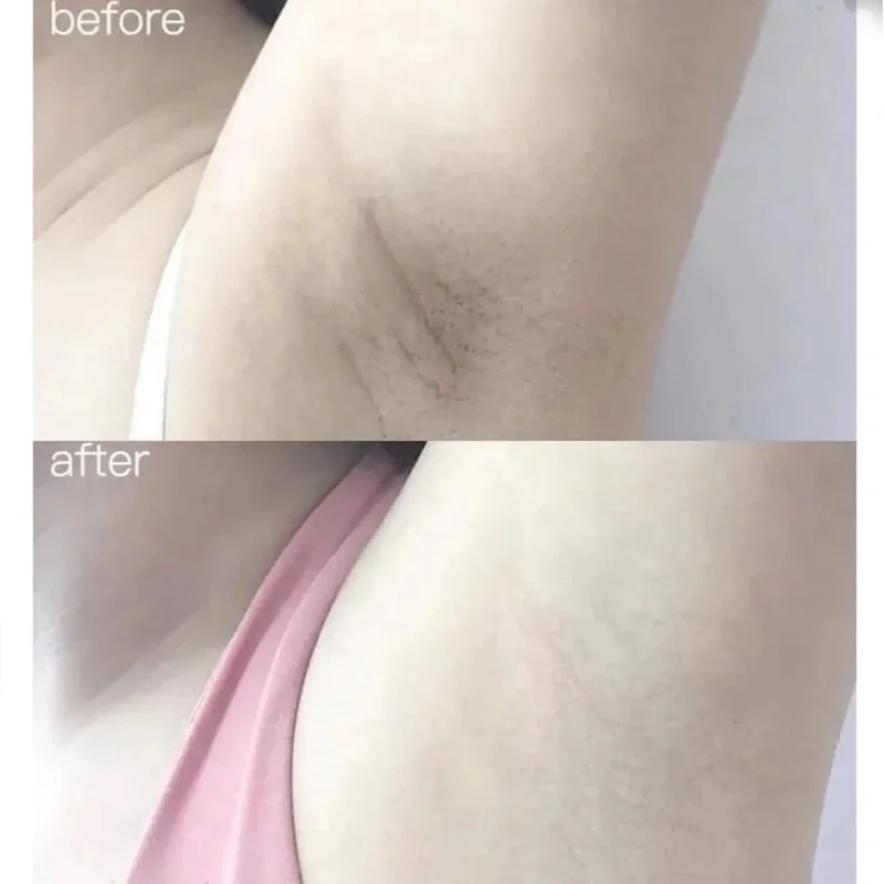 100ml Alpha Arbutin Collagen W - مراجعة Alpha Arbutin Serum وسعره