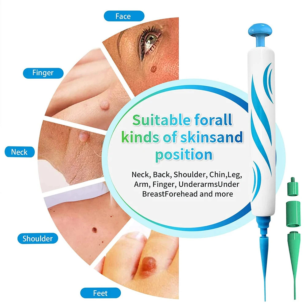 2 IN 1 Auto Micro Skin Tag Rem - مراجعة Skincare Ingredients Checker وسعره