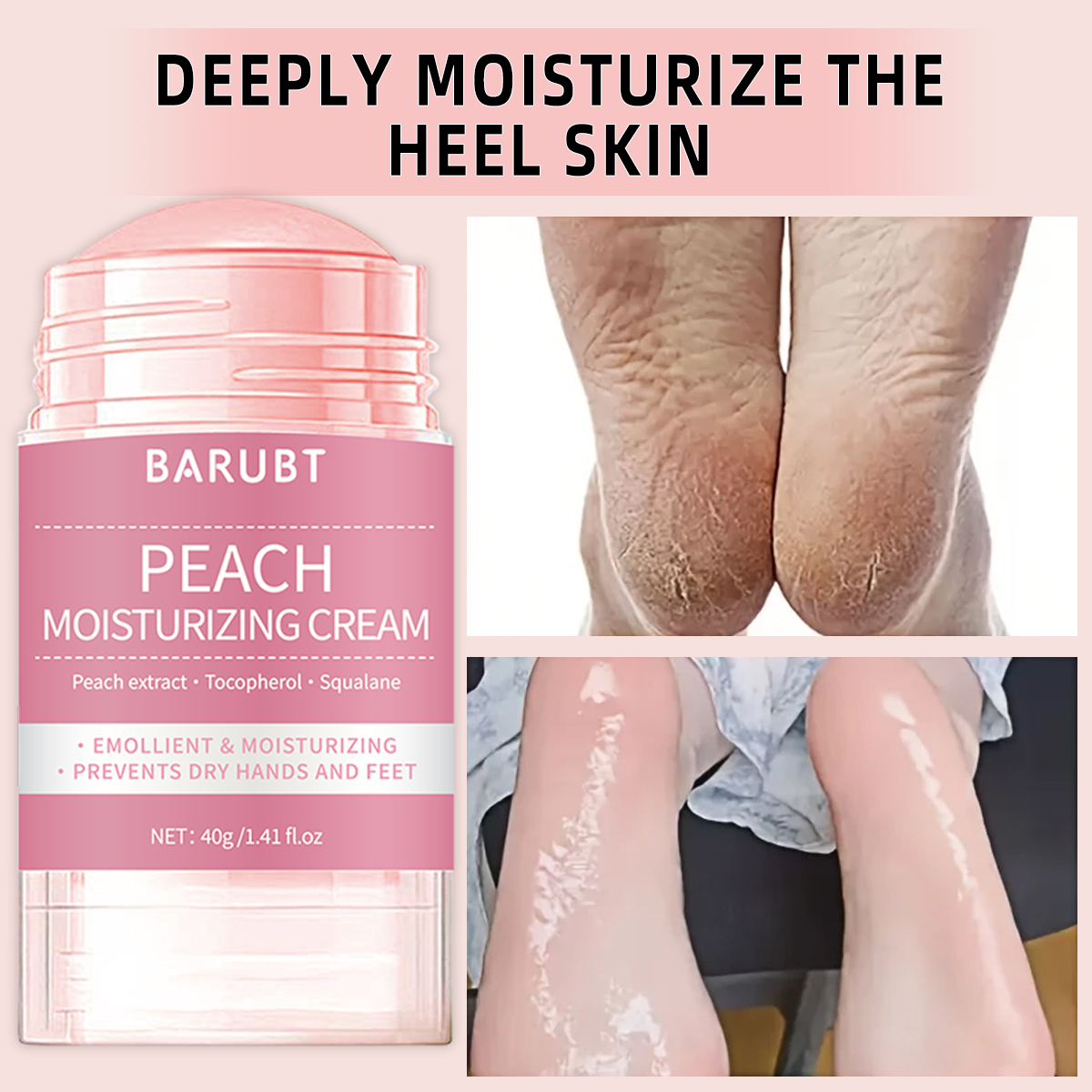 Peach urea mud film rod, salic - مراجعة Urea Foot Cream وسعره