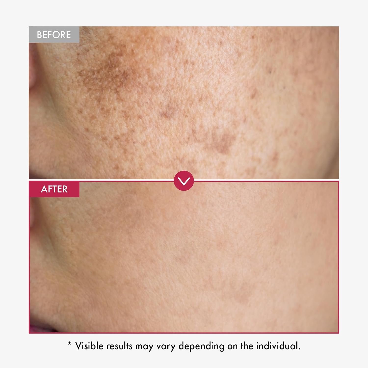 Alpha Arbutin Serum AHA Keeps  - مراجعة Alpha Arbutin Serum وسعره