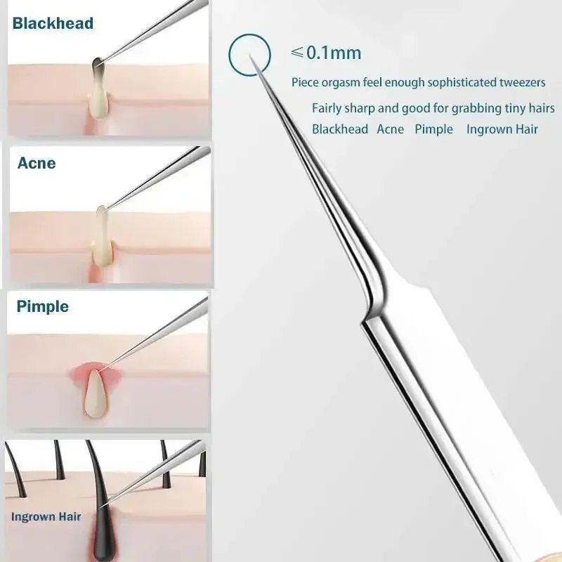 11Pcs/Set Acne Needle Blackhea - مراجعة Skincare Ingredients Checker وسعره