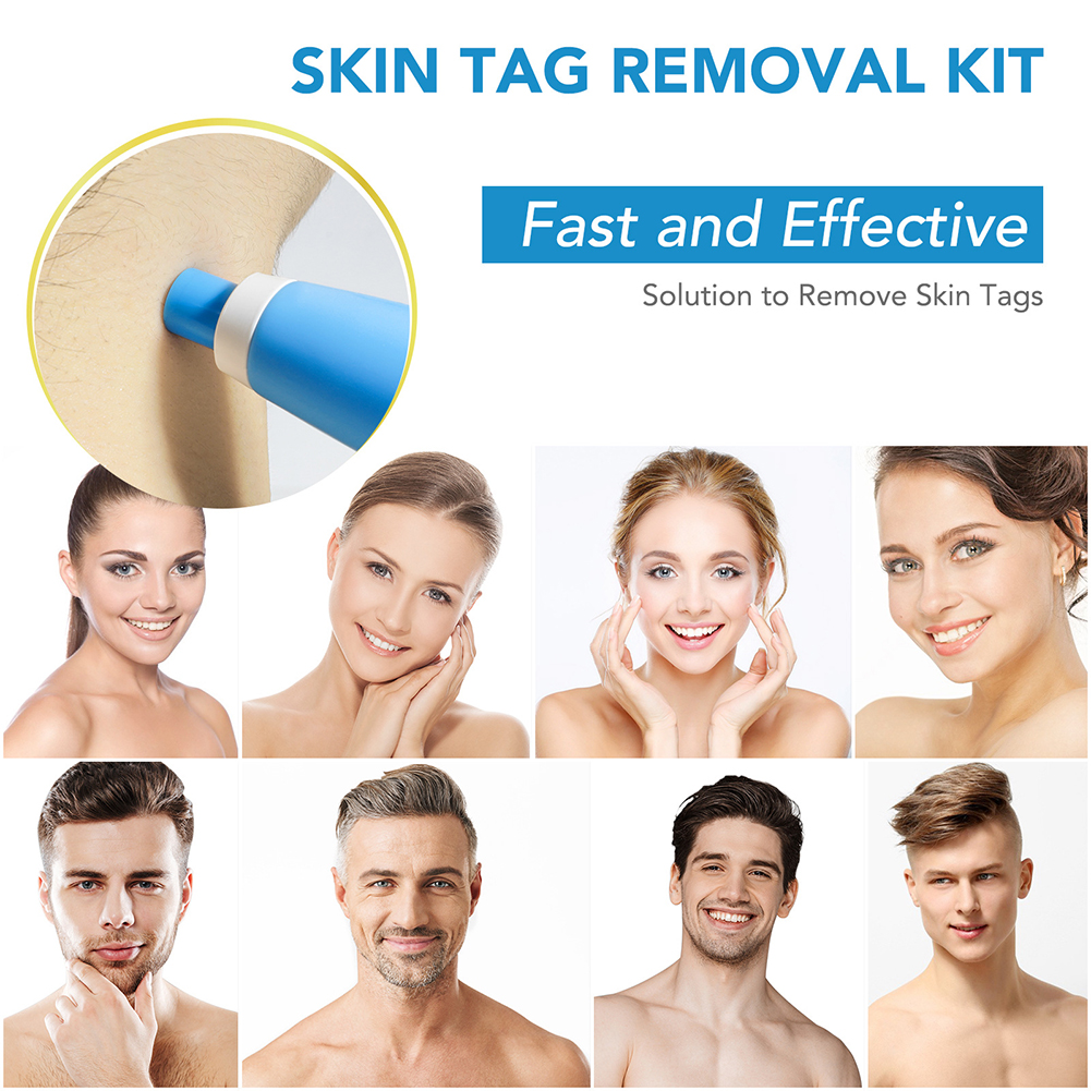 2-IN-1 Auto Skin Tag Removal K - مراجعة Skincare Ingredients Checker وسعره