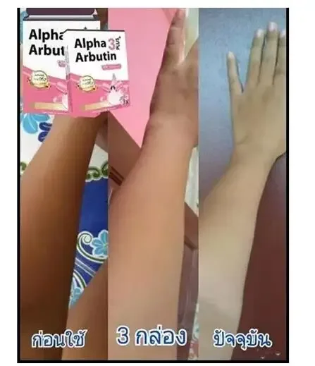 Alpha Arbutin 3 Plus Powder Mi - مراجعة Alpha Arbutin Serum وسعره