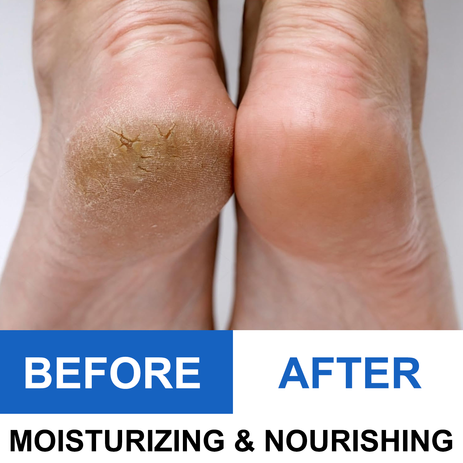 40% Urea Foot Cream Stick - Mo - مراجعة Urea Foot Cream وسعره